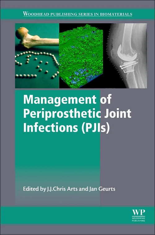 Coperta cărții "Management of Periprosthetic Joint Infections (PJIs)" de J.J. Chris Arts, Jan Geurts