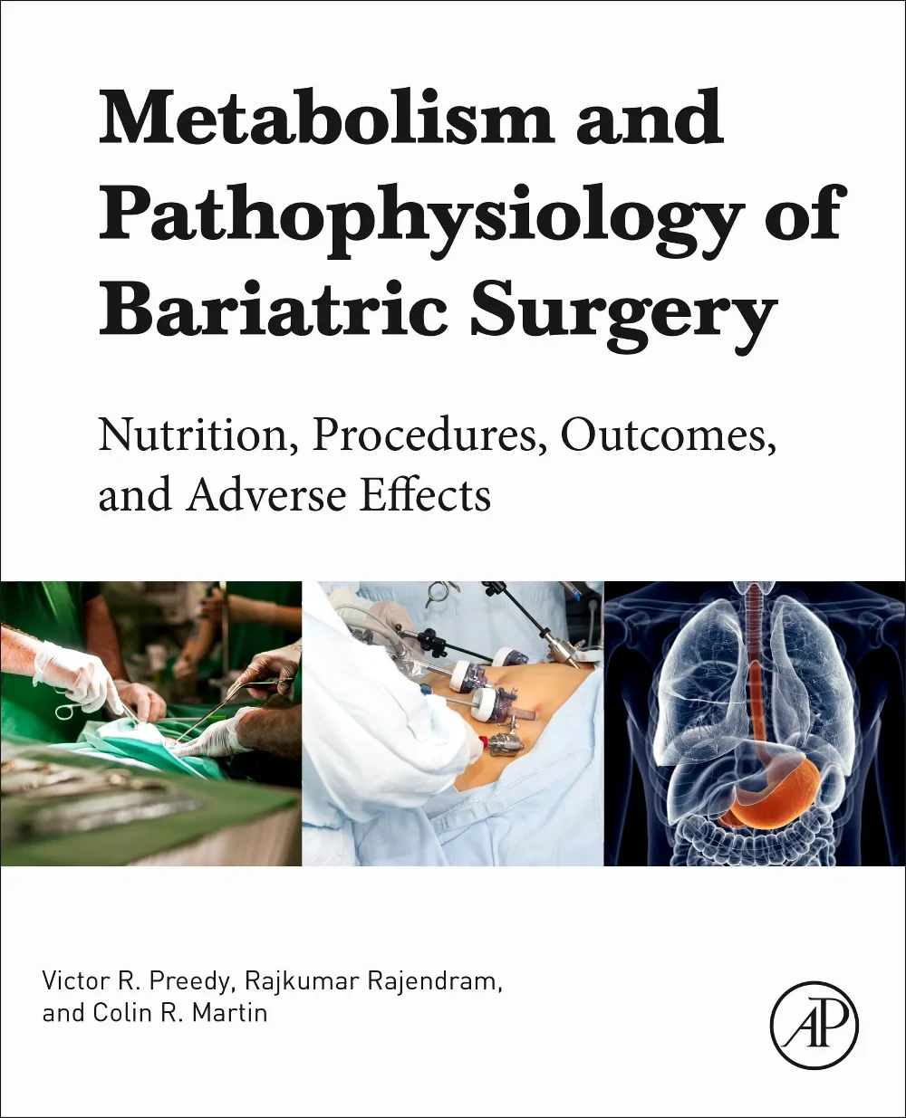 Coperta cărții "Metabolism and Pathophysiology of Bariatric Surgery: Nutrition Procedures, Outcomes and Adverse Effects" de Victor R. Preedy, Rajkumar Rajendram, Colin R. Martin