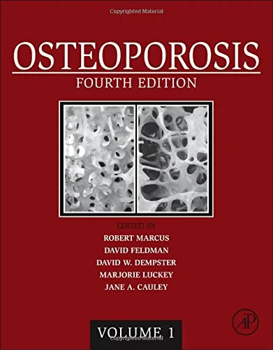 Coperta cărții "Osteoporosis, 4th Edition" de David W. Dempster, Jane A. Cauley, Mary L. Bouxsein, Felicia Cosman