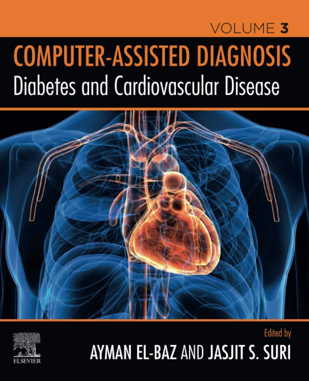 Coperta cărții "Diabetes and Cardiovascular Disease" de Jasjit S. Suri, Ayman S. El-Baz