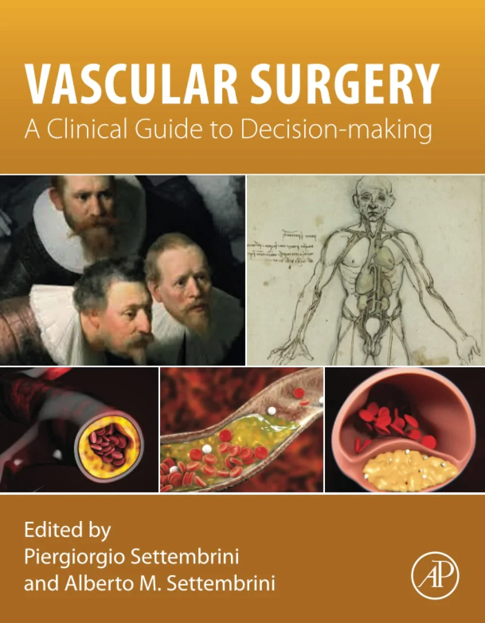 Coperta cărții "Vascular Surgery: A Clinical Guide to Decision-making " de Piergiorgio Settembrini, Alberto M. Settembrini