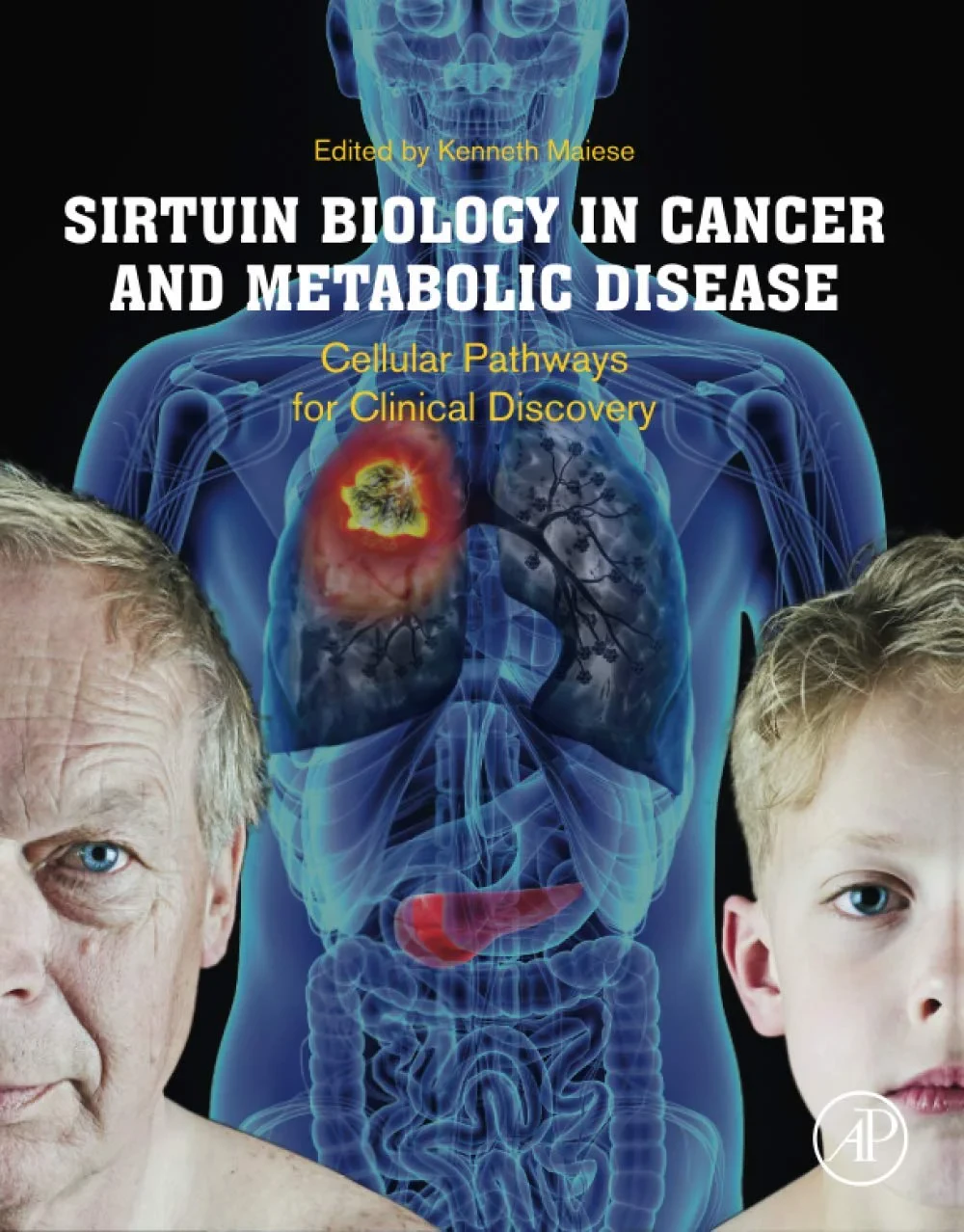 Coperta cărții "Sirtuin Biology in Cancer and Metabolic Disease" de Kenneth Maiese