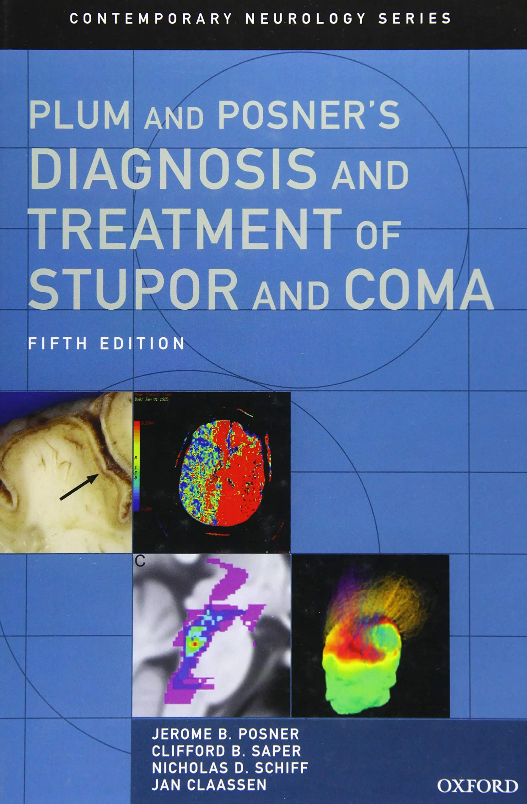Coperta cărții "Plum and Posner's Diagnosis and Treatment of Stupor and Coma" de Jerome B. Posner MD, Clifford B. Saper MD PhD, Nicholas D. Schiff MD