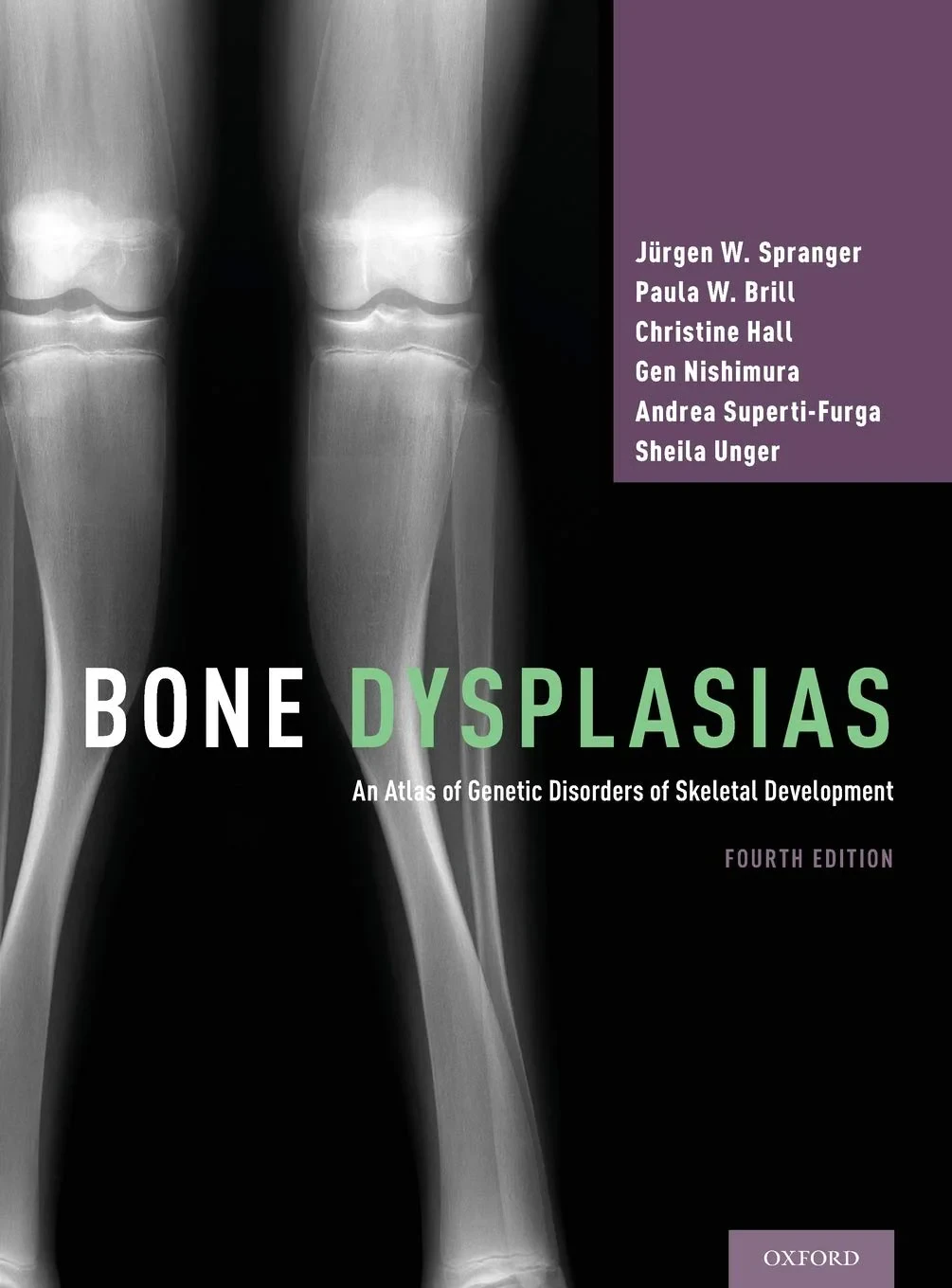 Bone Dysplasias: An Atlas of Genetic Disorders of ...