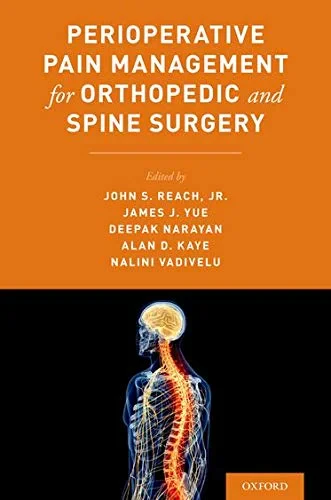 Coperta cărții "Perioperative Pain Management for Orthopedic and Spine Surgery" de Alan Kaye, John Reach, James J. Yue, Deepak Narayan, Nalini Vadivelu