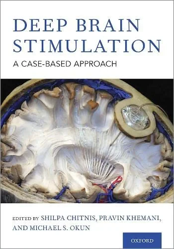 Coperta cărții "Deep Brain Stimulation: A Case-Based Approach" de Shilpa Chitnis, Pravin Khemani, Michael S. Okun