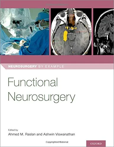Coperta cărții "Functional Neurosurgery (Neurosurgery by Example) " de Dr. Ahmed Raslan, Ashwin Viswanathan