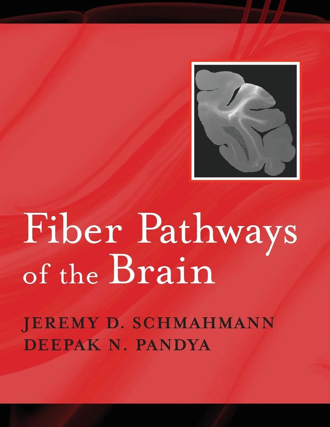 Coperta cărții "Fiber Pathways of the Brain" de Jeremy D. M.D. Schmahmann, Deepak N. Pandya