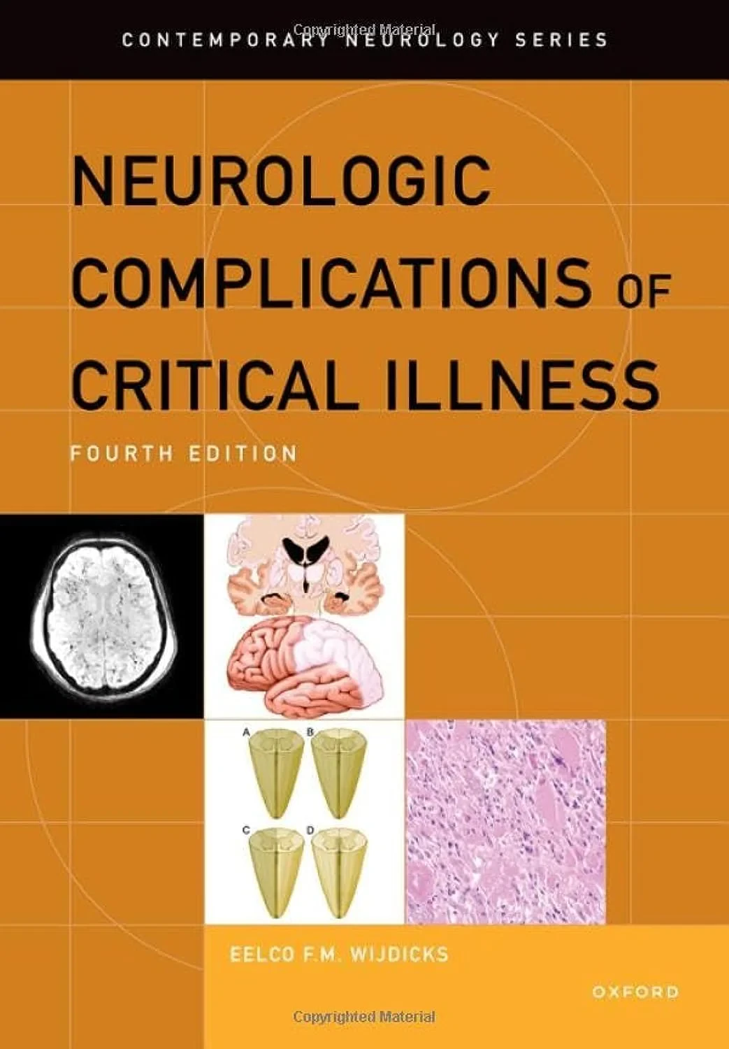 Coperta cărții "Neurologic Complications of Critical Illness" de Eelco F.M. Wijdicks