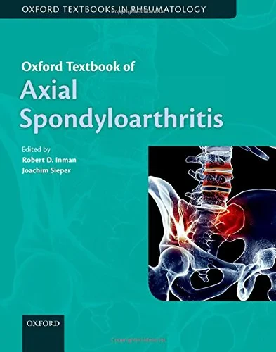 Coperta cărții "Oxford Textbook of Axial Spondyloarthritis" de Robert Inman and Joachim Sieper