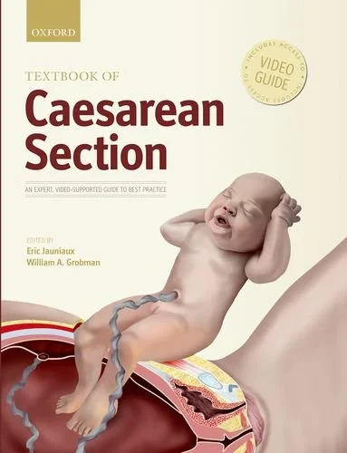 Coperta cărții "Textbook of Caesarean Section" de Eric Jauniaux and William Grobman