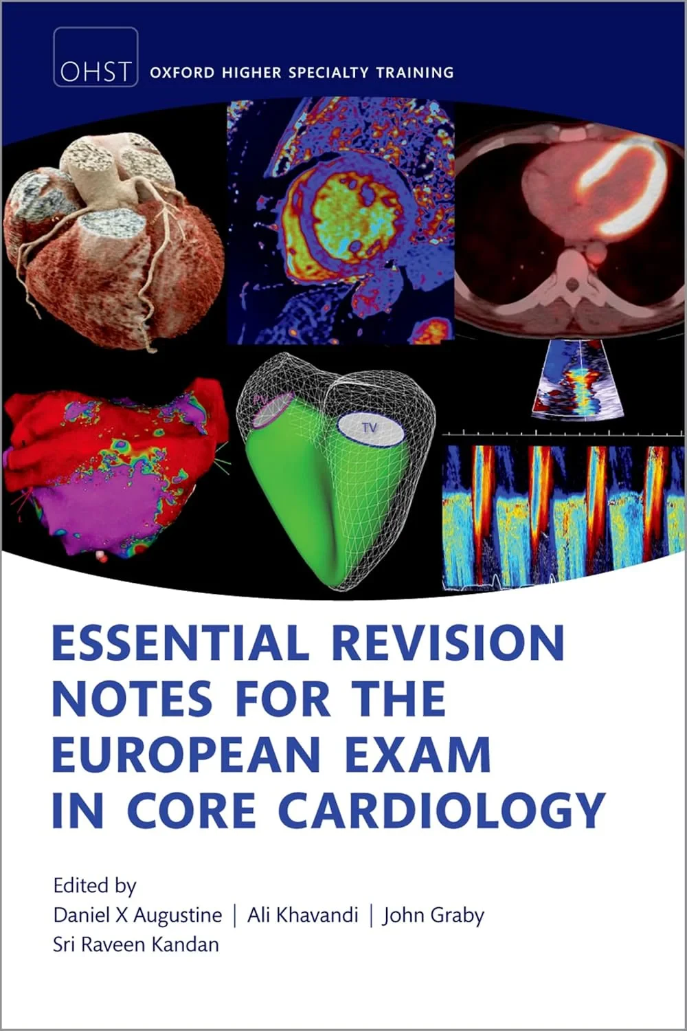 Coperta cărții "Essential Revision notes for the European Exam in Core Cardiology" de Prof Daniel X Augustine, Dr John Graby, Dr Ali Khavandi, and Dr Sri Raveen Kandan