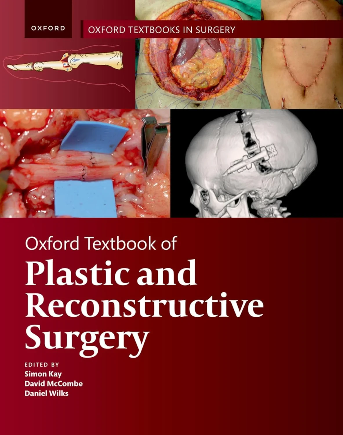 Oxford Textbook of Plastic and Reconstructive Surg...