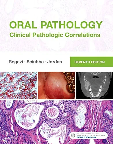 Coperta cărții "Oral Pathology: Clinical Pathologic Correlations, 7e" de Joseph A. Regezi DDS MS (Author), James Sciubba DMD PhD, Richard C. K. Jordan DDS MSc PhD FRCD(C) FRCPATH