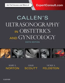 Coperta cărții "Callen’s Ultrasonography in Obstetrics and Gynecology, 6th Edition" de M  Norton
