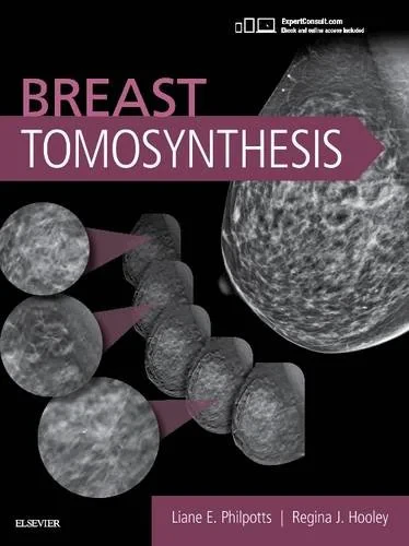 Coperta cărții "Breast Tomosynthesis" de Liane E Philpotts, Regina J Hooley