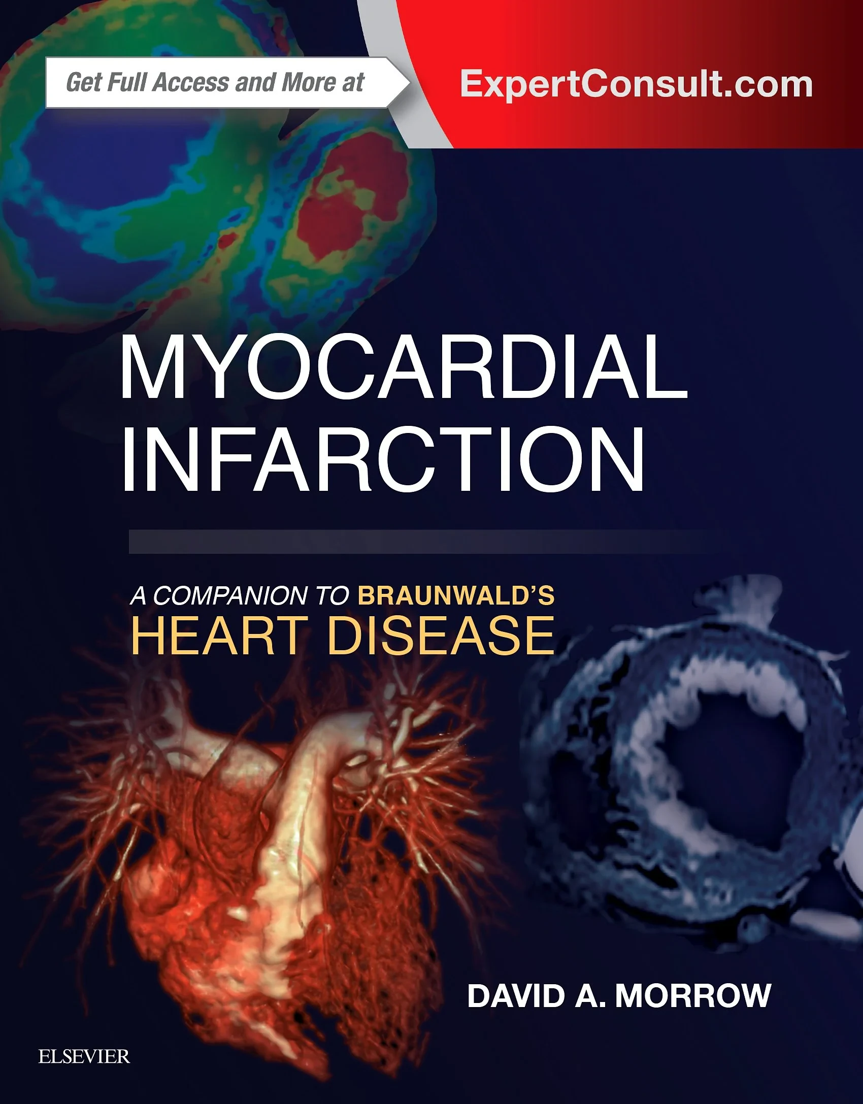Coperta cărții "Myocardial Infarction: A Companion to Braunwald’s Heart Disease" de David A Morrow