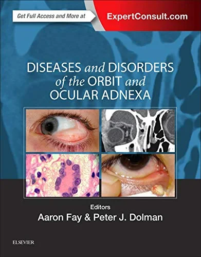 Coperta cărții "Diseases and Disorders of the Orbit and Ocular Adnexa, 1e" de Aaron Fay, Peter J Dolman