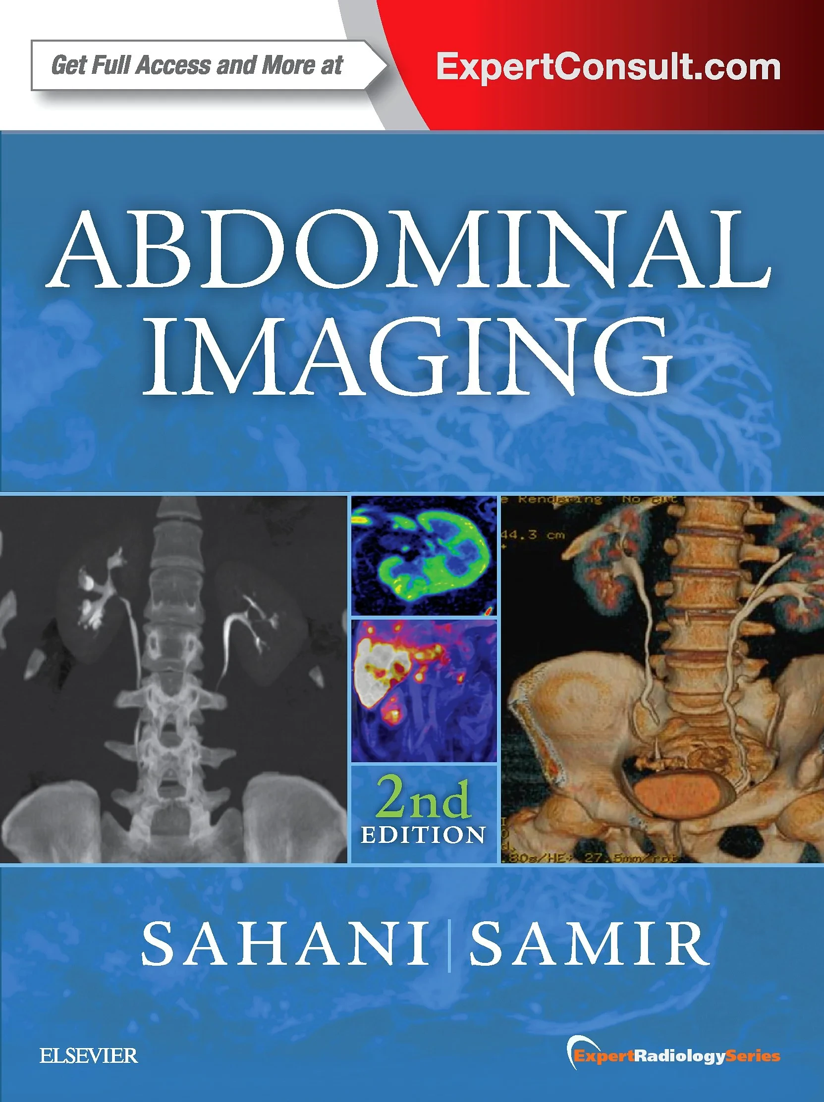 Coperta cărții "Abdominal Imaging, 2nd Edition" de Dushyant V Sahani, Anthony E Samir