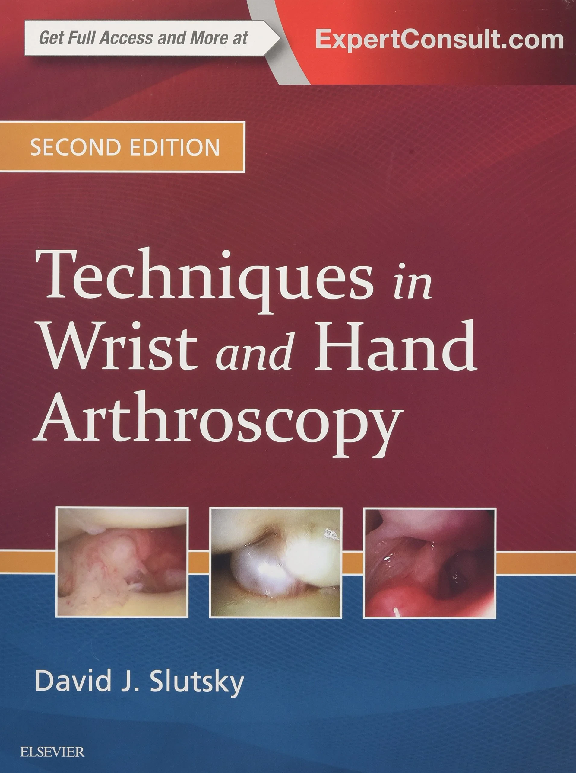 Coperta cărții "Techniques in Wrist and Hand Arthroscopy, 2nd Edition" de David J. Slutsky