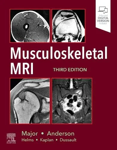 Coperta cărții "Musculoskeletal MRI, 3rd Edition" de Mark W. Anderson MD, Nancy M. Major