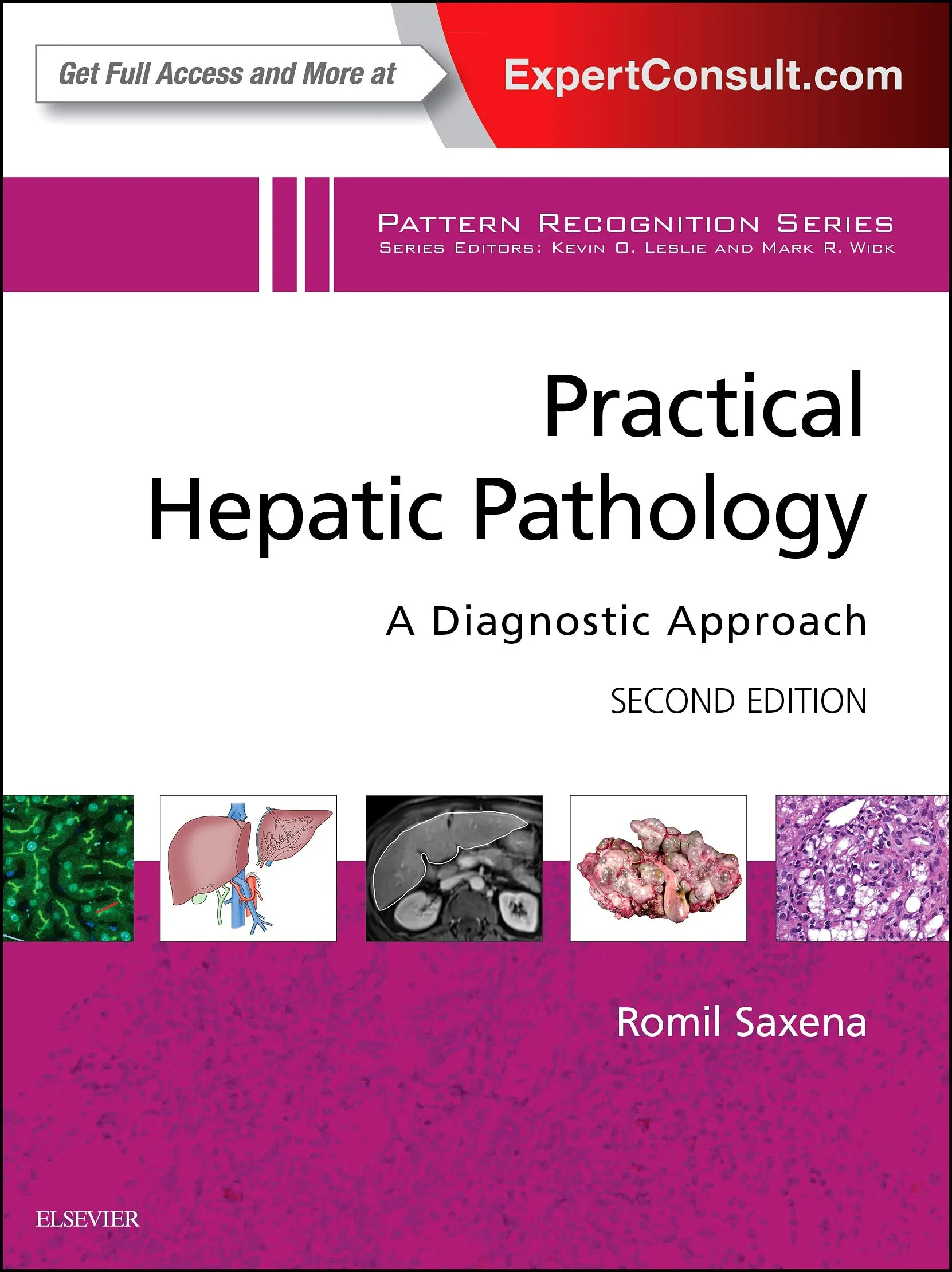 Coperta cărții "Practical Hepatic Pathology: A Diagnostic Approach: A Volume in the Pattern Recognition Series" de Romil Saxena MD FRCPath