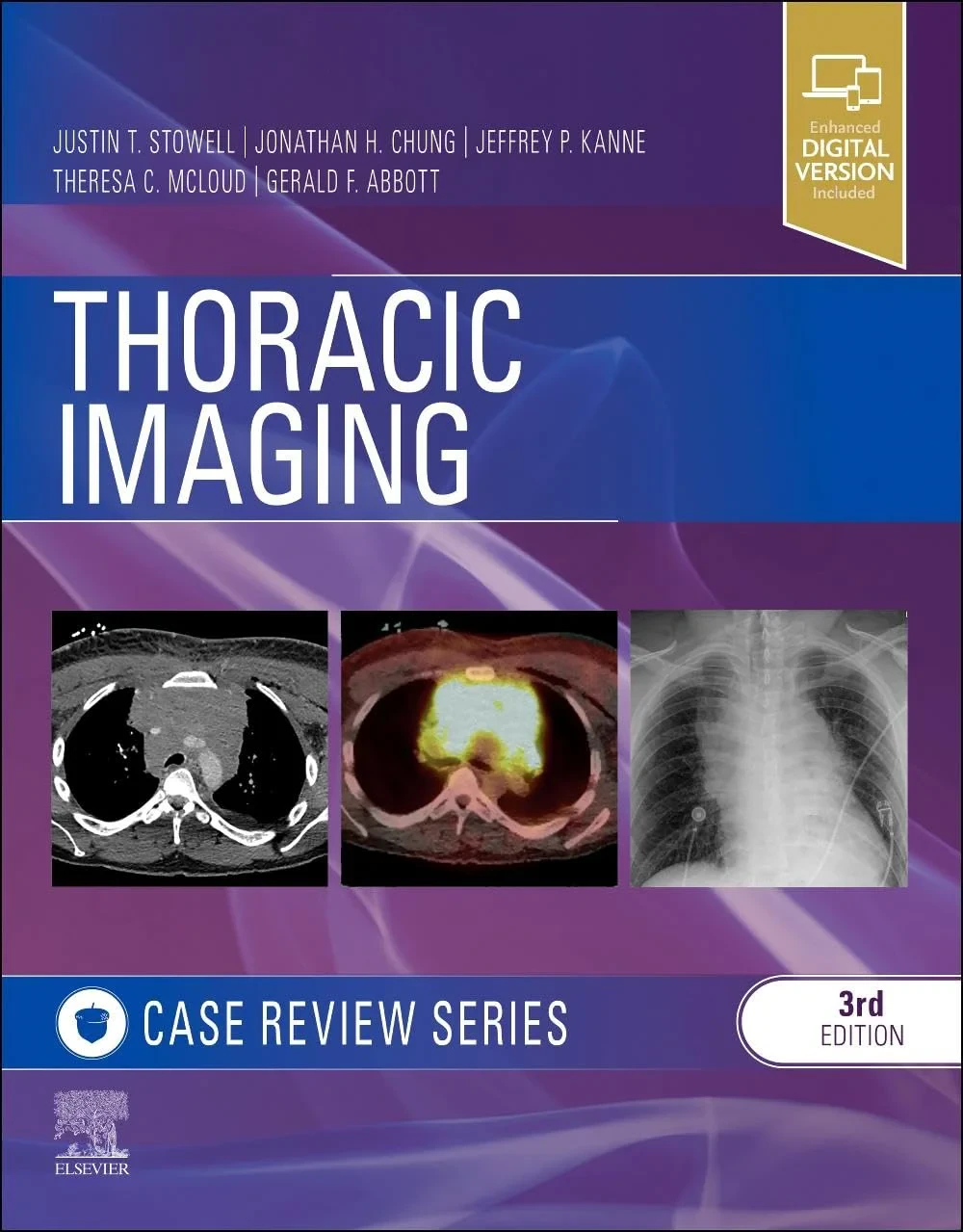 Coperta cărții "Thoracic Imaging: Case Review" de Justin T. Stowell, Jonathan H. Chung, Jeffrey P Kanne, Theresa C. McLoud, Gerald F. Abbott