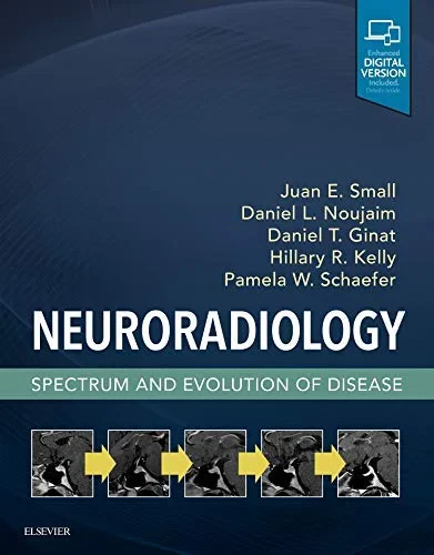 Coperta cărții "Neuroradiology: Spectrum and Evolution of Disease, 1e" de Juan E. Small MD MSc (Author), Daniel L. Noujaim MD (Author), Daniel T. Ginat MD MS
