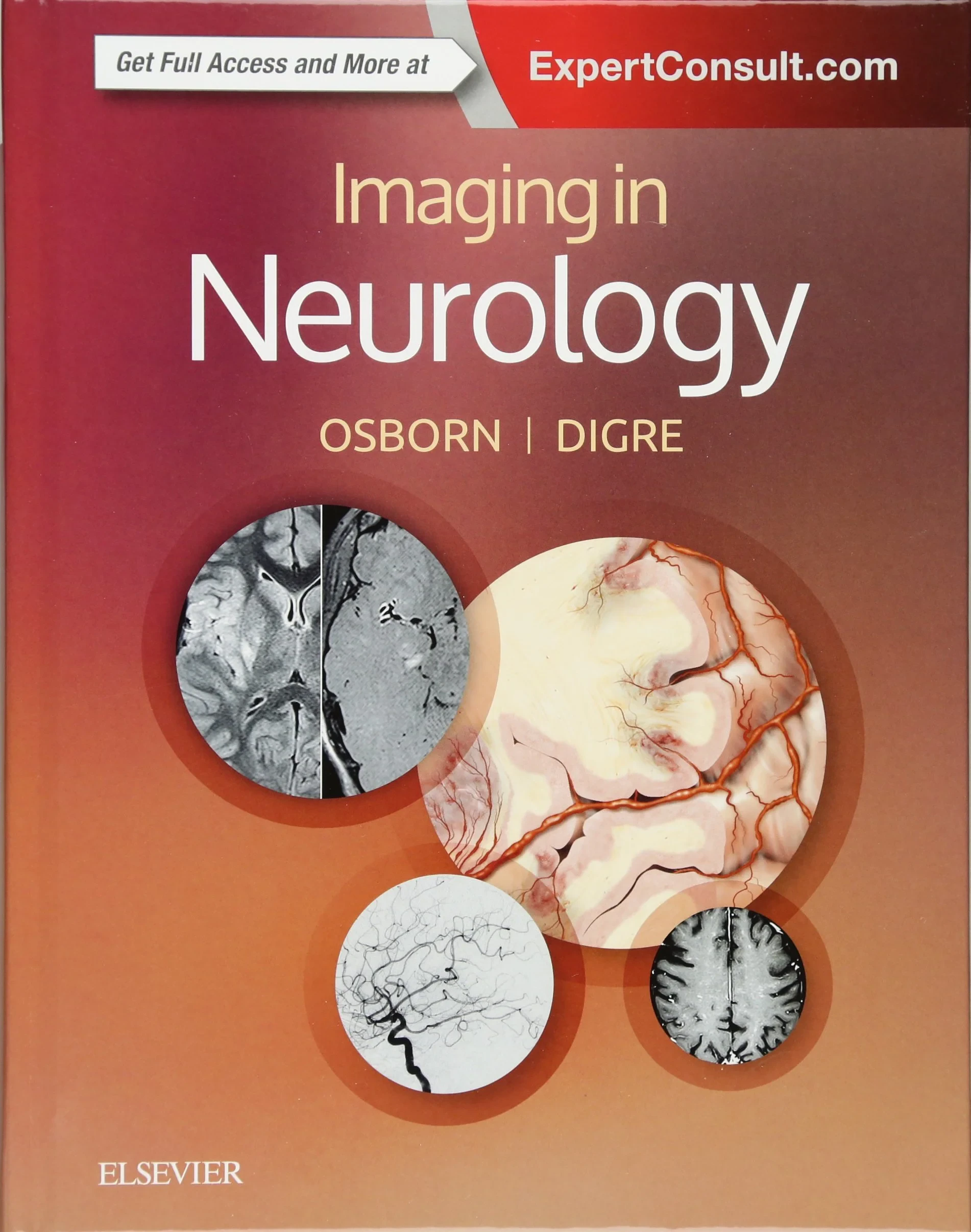 Coperta cărții "Imaging in Neurology" de Anne G. Osborn, Kathleen B. Digre