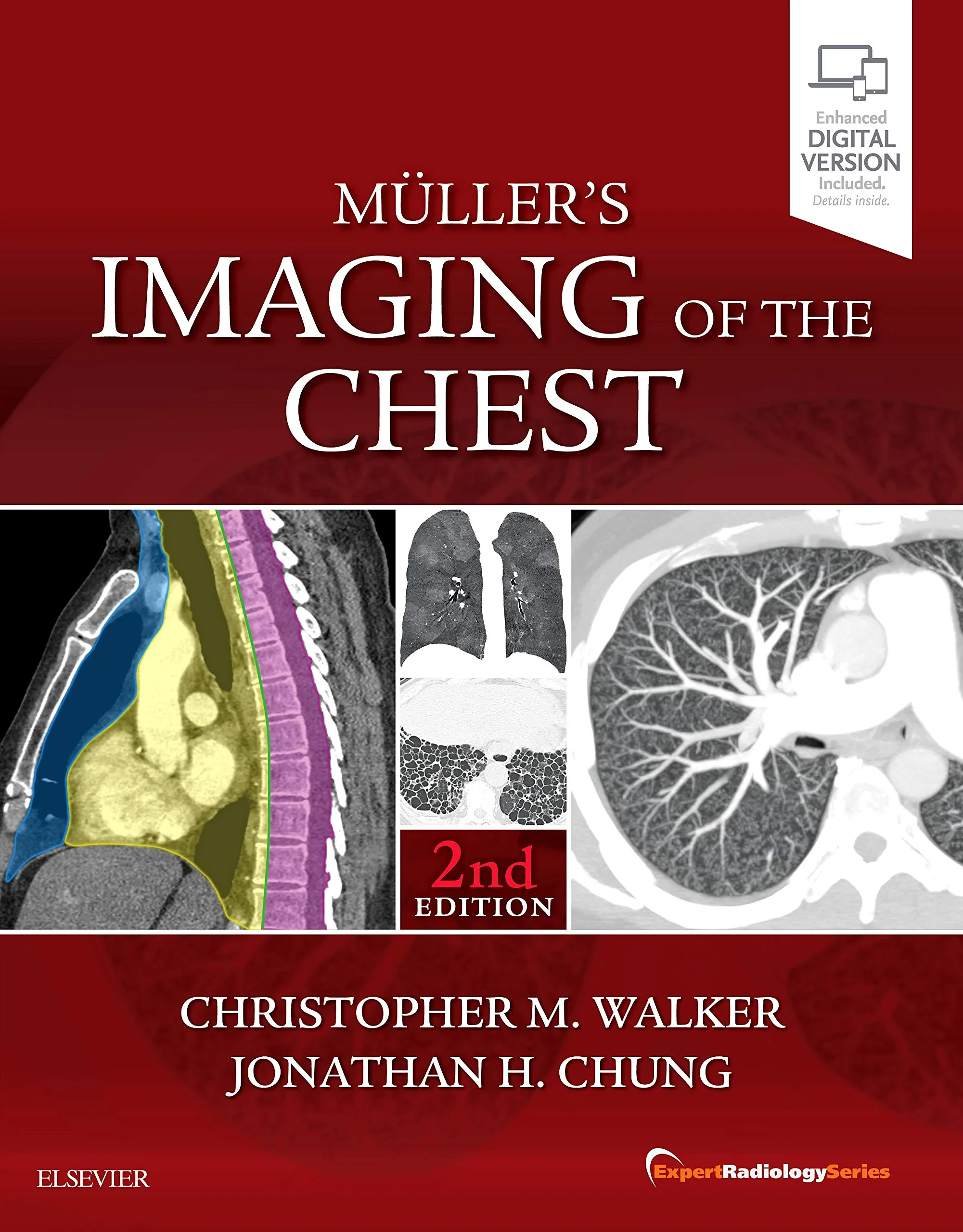 Coperta cărții "Muller's Imaging of the Chest: Expert Radiology Series, 2e " de Christopher M. Walke, Jonathan Hero Chung