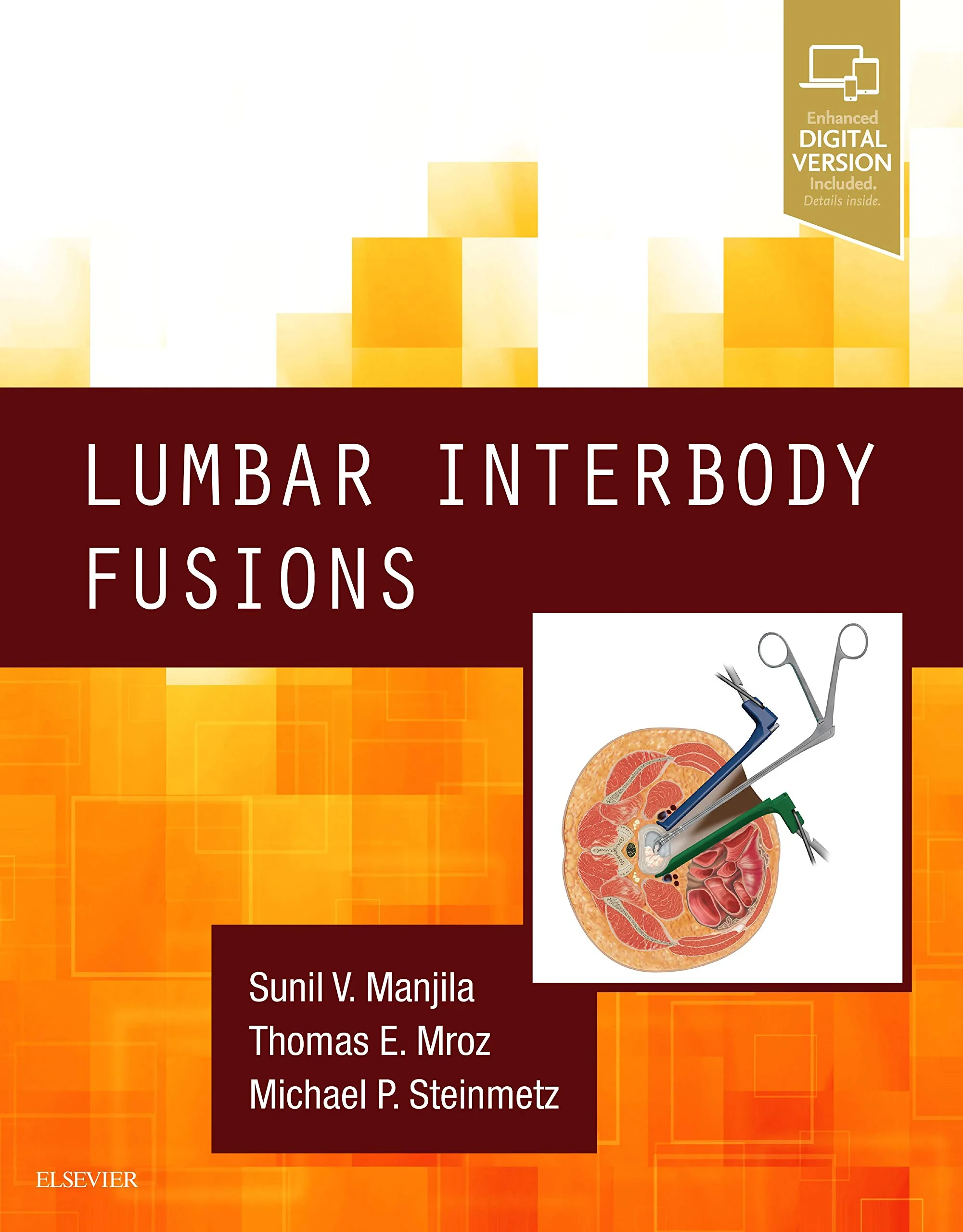 Coperta cărții "Lumbar Interbody Fusions, 1e" de Sunil V Manjila MD, Thomas Mroz MD, Michael P Steinmetz MD