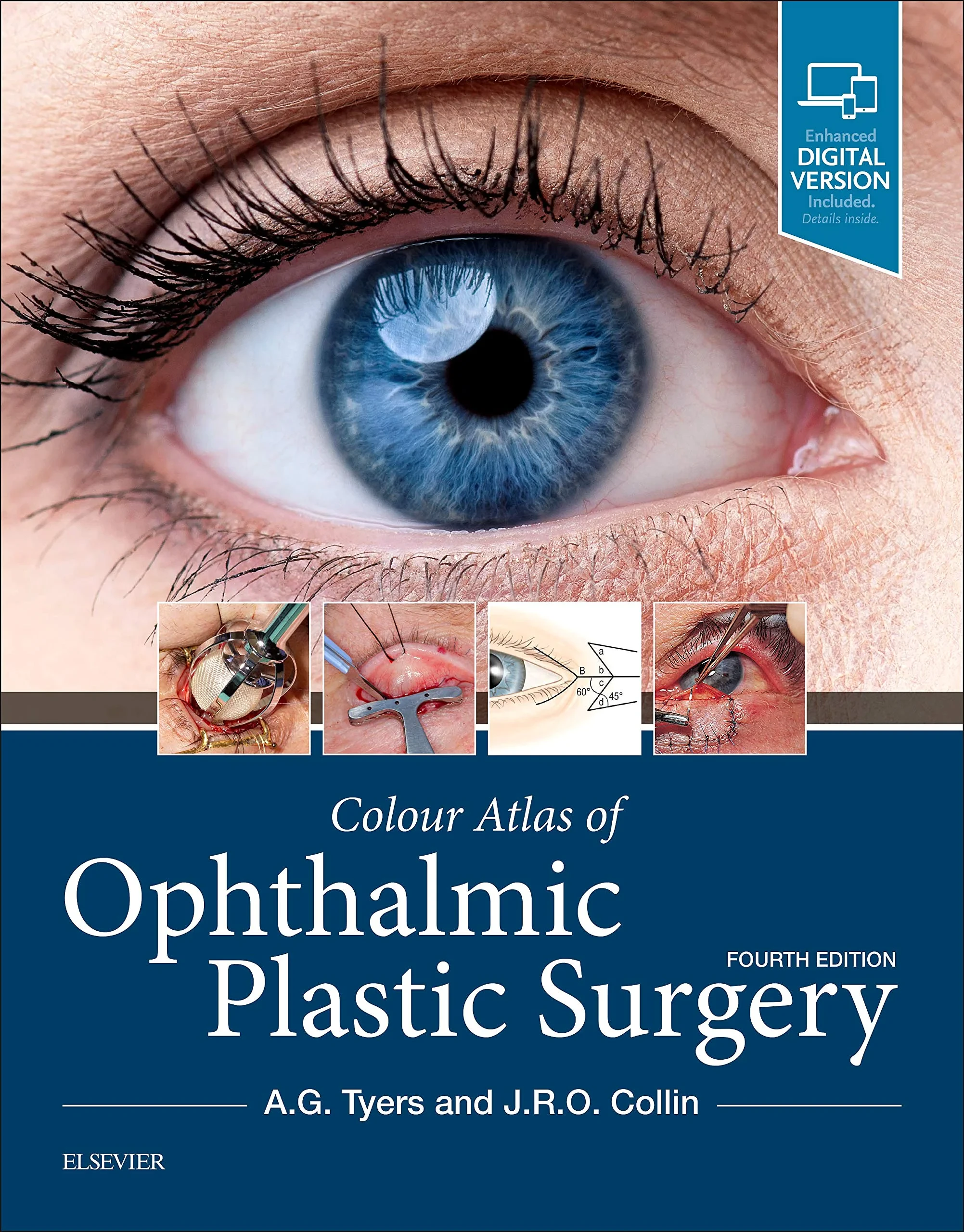 Coperta cărții "Colour Atlas of Ophthalmic Plastic Surgery, 4e" de Anthony G. Tyers FRCS(Eng) FRCS(Ed) FRCOphth, J. R. O. Collin MA MB Bchir FRCS FRCOphth DO