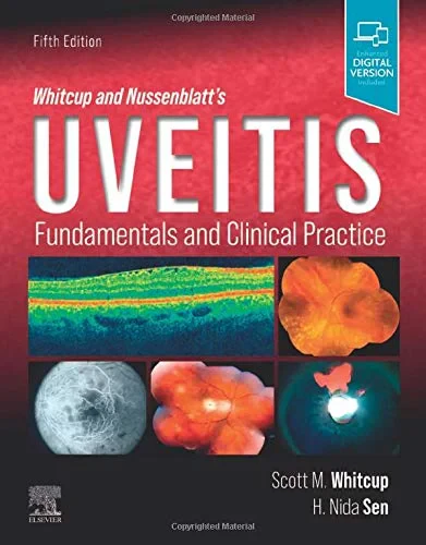 Coperta cărții "Whitcup and Nussenblatt’s Uveitis: Fundamentals and Clinical Practice " de Scott M. Whitcup, H. Nida Sen