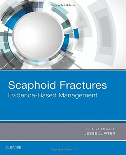 Coperta cărții "Scaphoid Fractures: Evidence-Based Management, 1e " de Geert Buijze MD, Jesse B. Jupiter