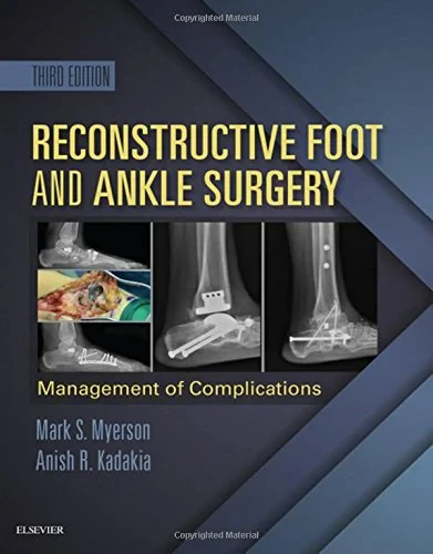 Coperta cărții "Reconstructive Foot and Ankle Surgery: Management of Complications, 3e" de Mark S. Myerson, Anish R. Kadakia