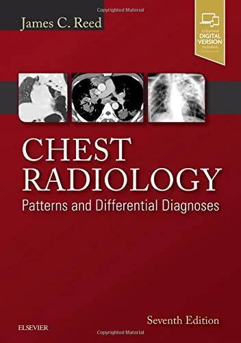 Coperta cărții "Chest Radiology: Patterns and Differential Diagnoses" de James C. Reed MD