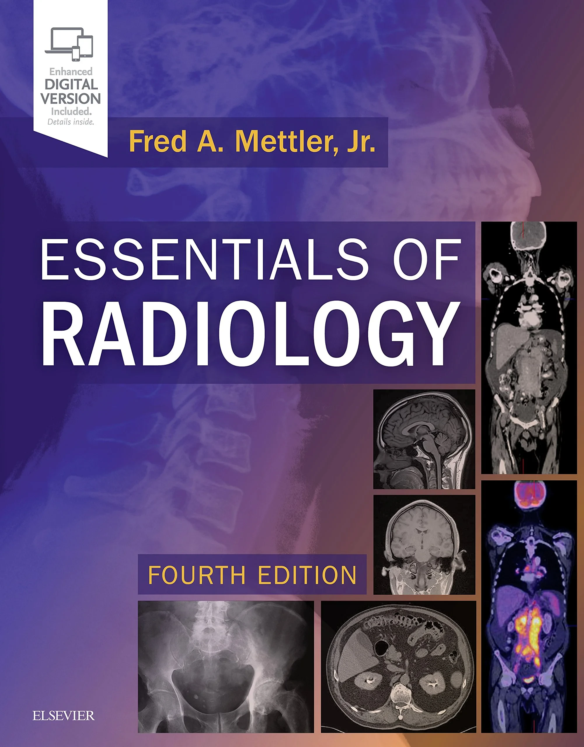 Coperta cărții "Essentials of Radiology: Common Indications and Interpretation, 4e " de Fred A. Mettler Jr. MD MPH
