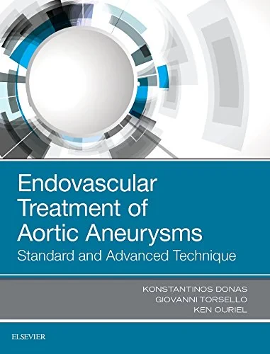 Coperta cărții "Endovascular Treatment of Aortic Aneurysms" de Konstantinos Donas; Giovanni Torsello, Ken Ouriel, Konstantinos Donas, Giovanni Torsello
