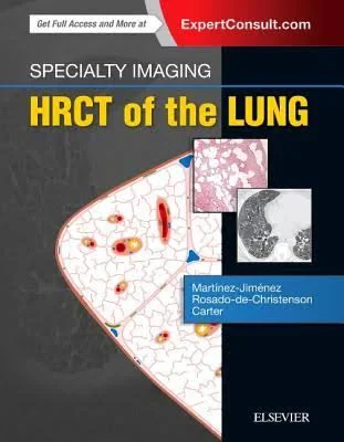 Coperta cărții "Specialty Imaging: HRCT of the Lung, 2e" de Santiago Martinez-Jimenez