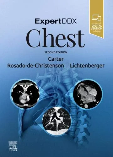 Coperta cărții "ExpertDDx: Chest, 2nd Edition" de Brett W. Carter