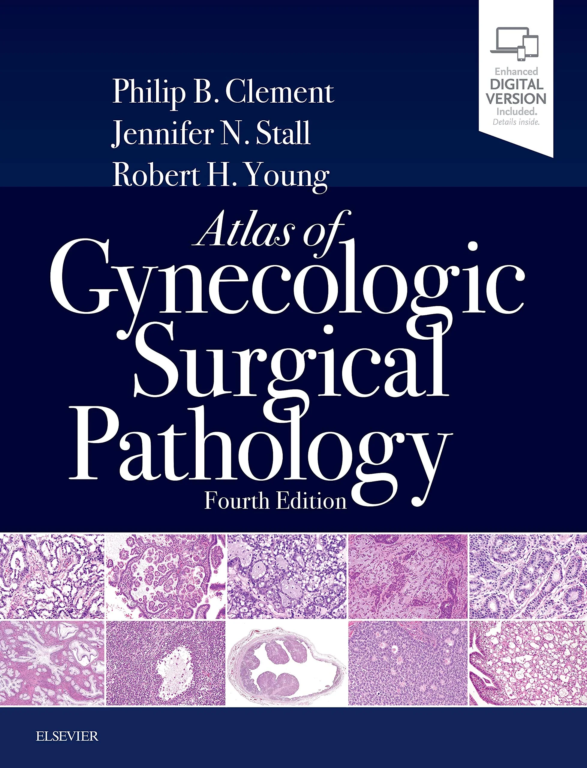 Coperta cărții "Atlas of Gynecologic Surgical Pathology, 4th Edition" de Philip B. Clement