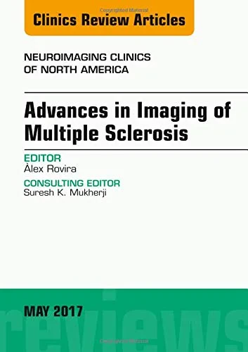 Coperta cărții "Advances in Imaging of Multiple Sclerosis, An Issue of Neuroimaging Clinics of North America, Volume 27-2" de Rovira