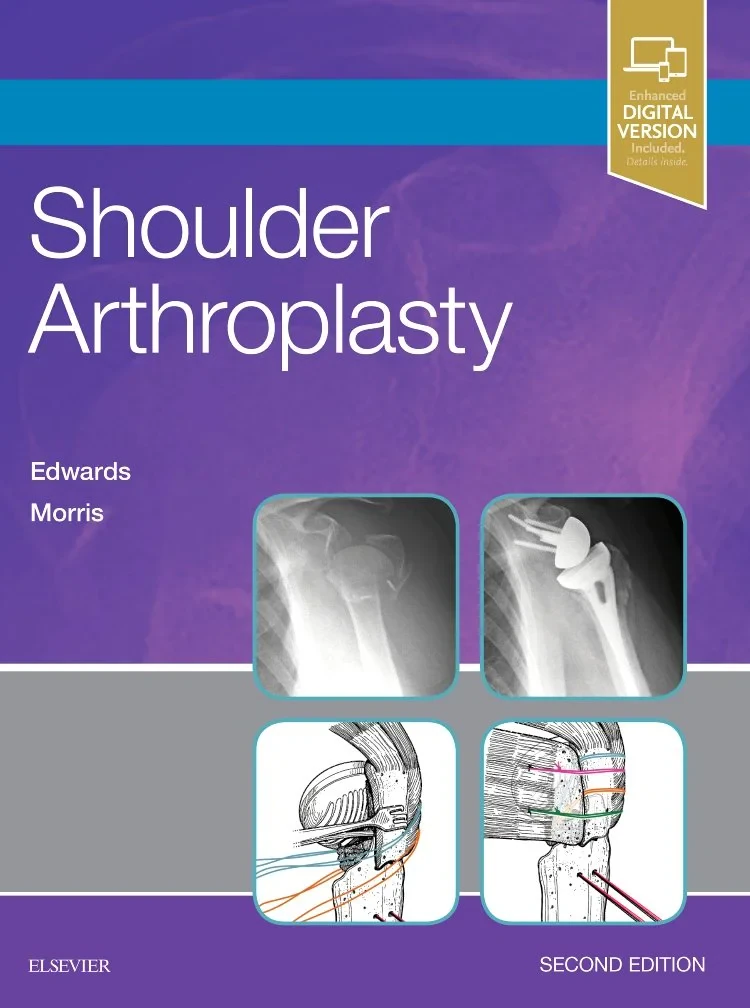 Coperta cărții "Shoulder Arthroplasty, 2e " de T. Bradley Edwards MD (Author), Brent J. Morris MD
