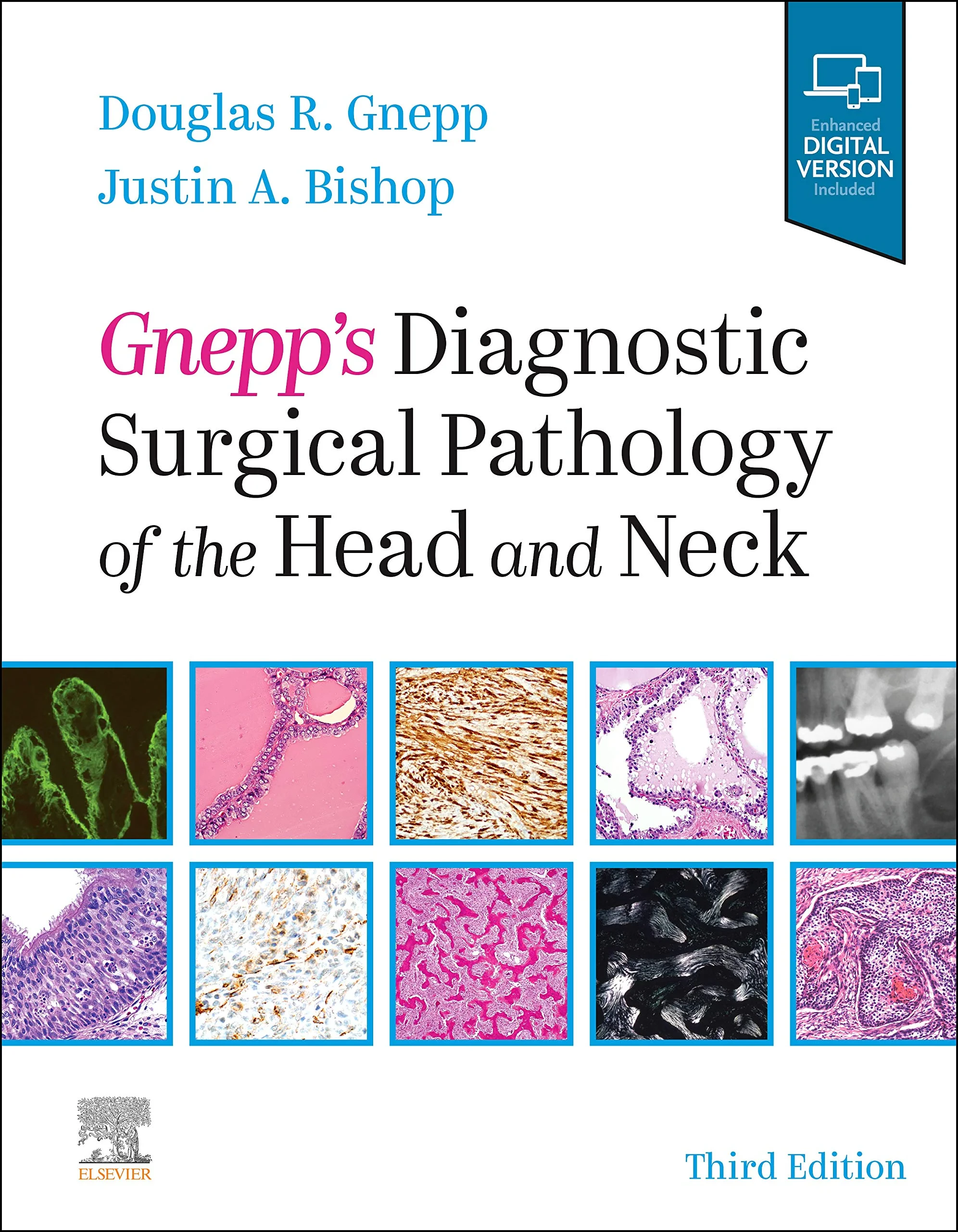 Coperta cărții "Gnepp's Diagnostic Surgical Pathology of the Head and Neck: Expert Consult - Online and Print" de Douglas R. Gnepp MD, Justin A. Bishop MD