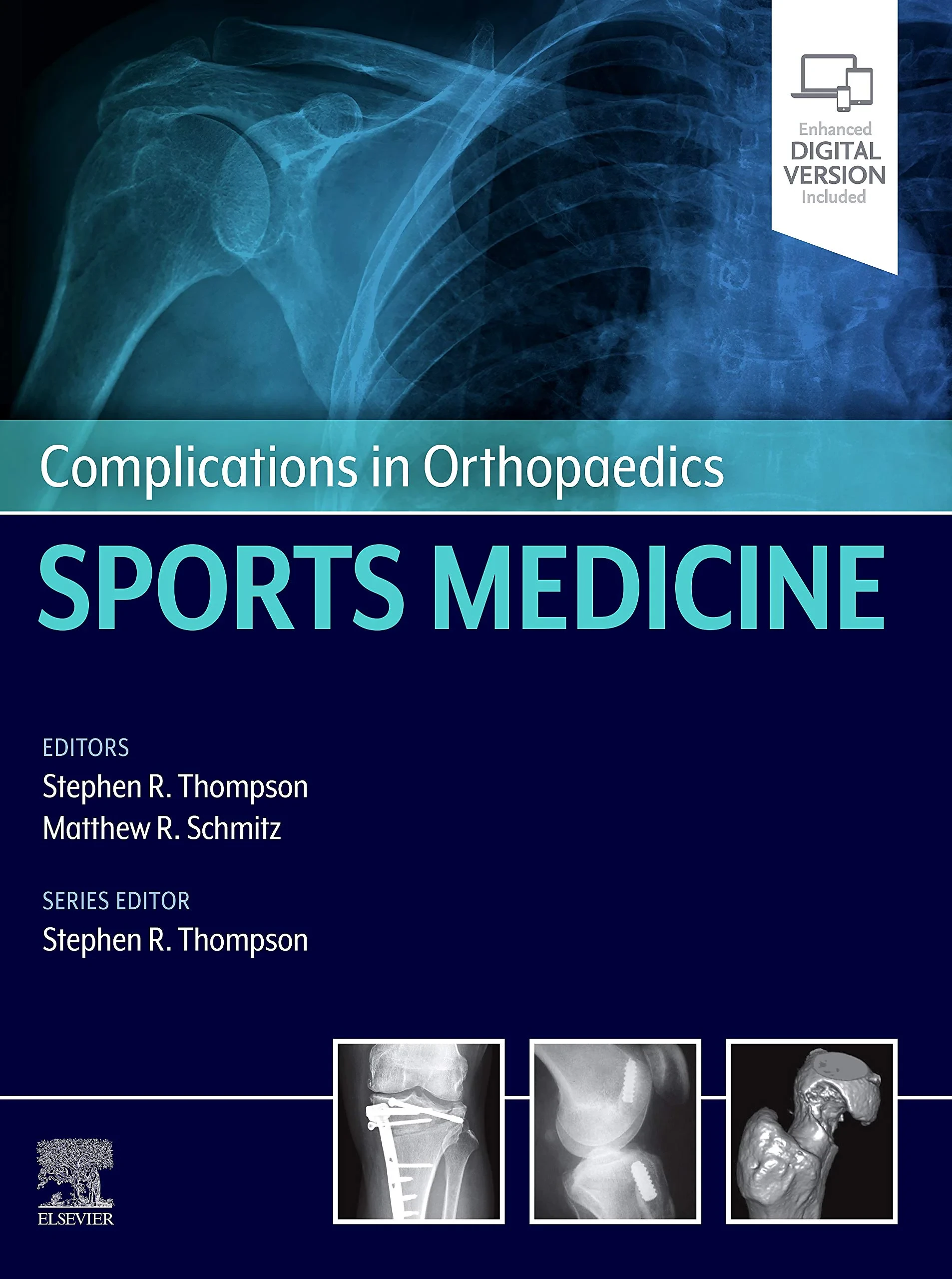 Coperta cărții "Complications in Orthopaedics: Sports Medicine " de Stephen R. Thompson, Matthew Schmitz