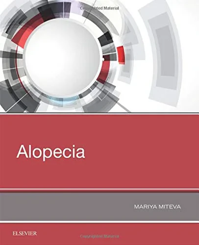 Coperta cărții "Alopecia" de Miteva