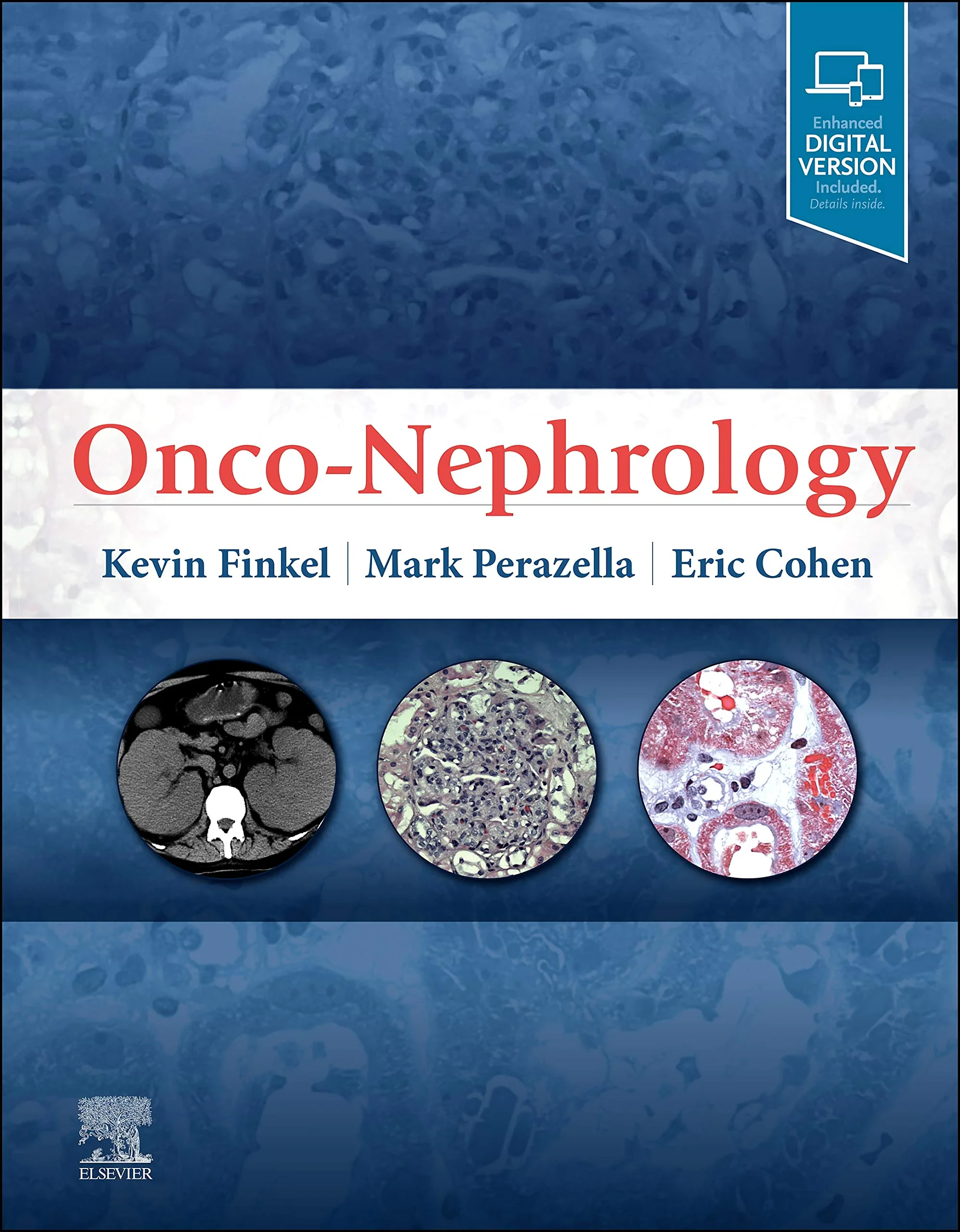 Coperta cărții "Onco-Nephrology " de MD, USA, Chief, Professor, Houston, Kevin W. Finkel, Professor and Clinical Vice-Chairman of Medicine; Director, Division of Renal Diseases &amp; Hypertension; Chief, Section of Critical Care Nephrology, University of Texas Medical School, TX, USA ; Mark Anthony Perazella, MD and Eric P Cohen, University of Maryland School of Medicine, Baltimore, Maryland, Professor and Clinical Vice-Chairman of Medicine, Director, Division of Renal Diseases &amp; Hypertension, Mark Anthony Perazella