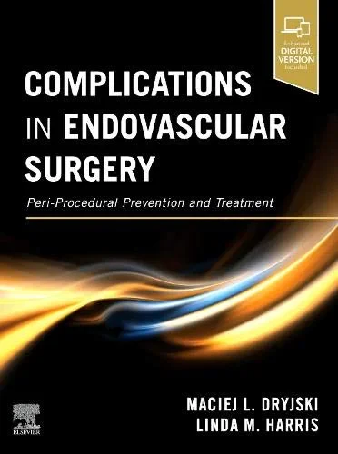 Coperta cărții "Complications in Endovascular Surgery" de Maciej Dryjski, Linda M Harris