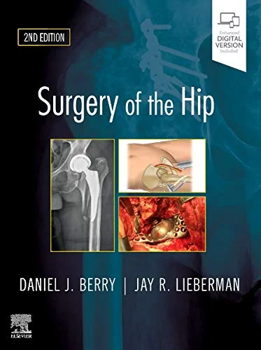 Coperta cărții "Surgery of the Hip, 2nd Edition" de Daniel J. Berry