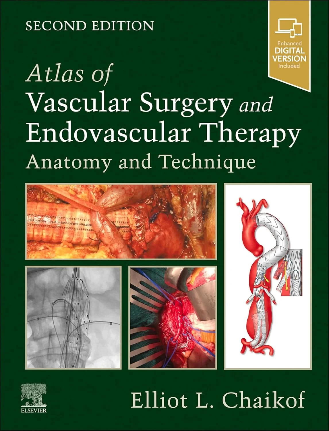 Coperta cărții "Atlas of Vascular Surgery and Endovascular Therapy : Anatomy and Technique" de Elliot L. Chaikof